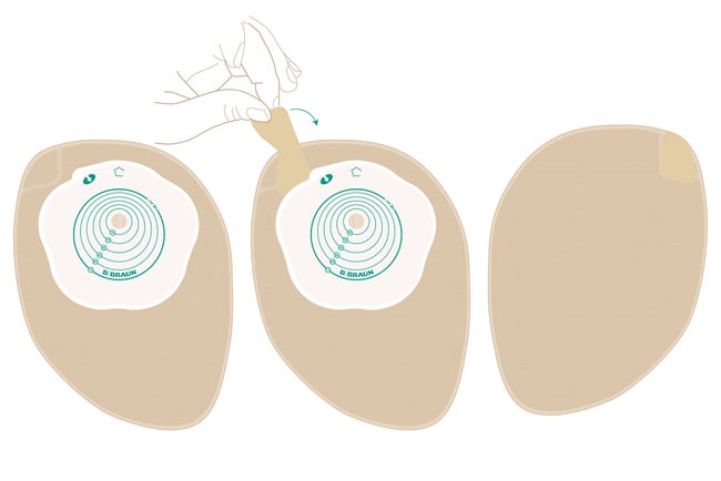 Illustration filtres