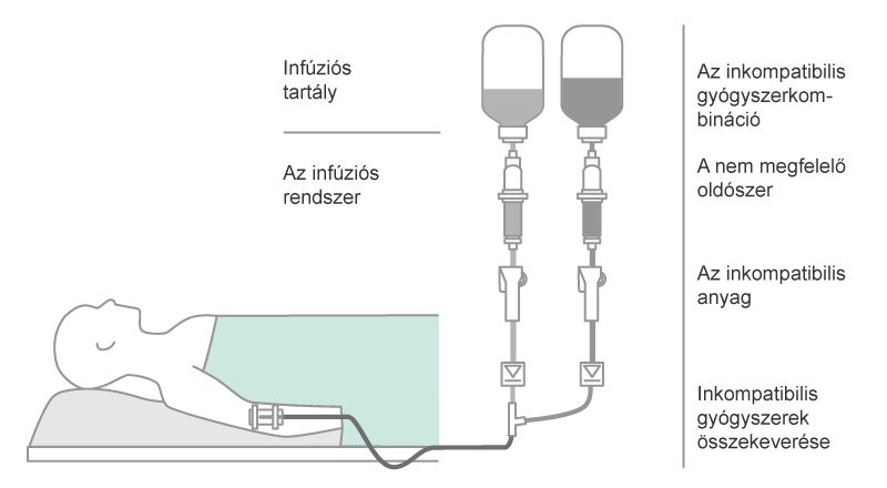 Parallel infusion in standard IV therapy.
