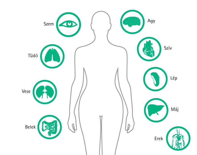 Parts and organs of the human body mainly affected by particulate contamination of IV fluids: Eye, Lung, Kidney, Intestine, Brain, Heart, Spleen, Liver, Blood Vessels.