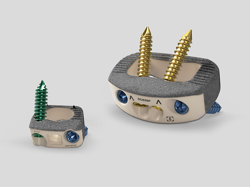 Plasmapore XP bevonatú csigolyaközi fúziós implantátumok.